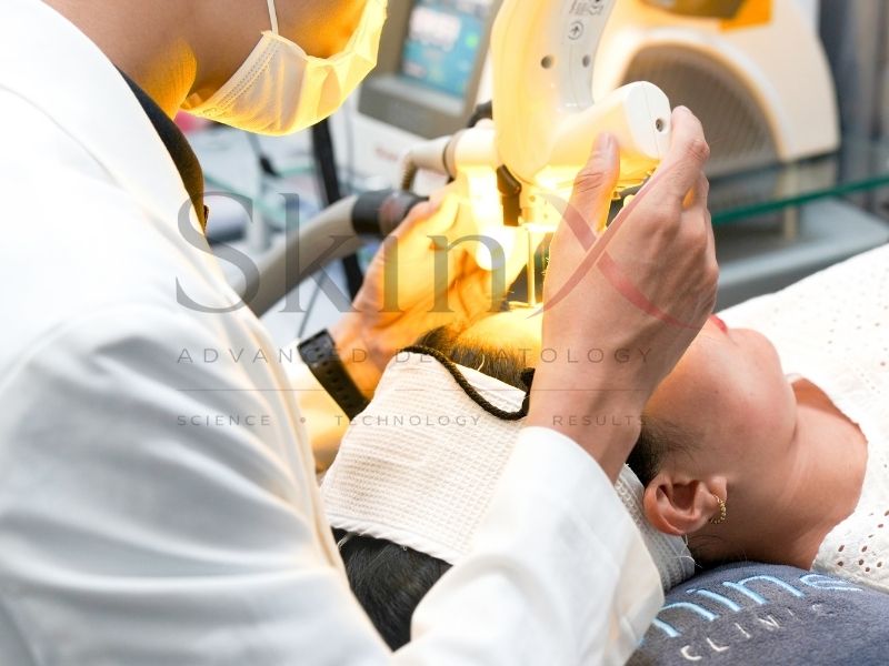 Làn da sau khi dùng laser sẽ khỏe hơn dần 